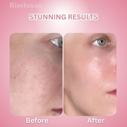 Brightening Turmeric & Kojic Acid Pads