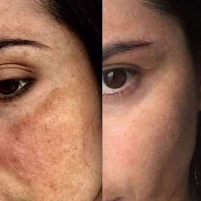 SeoulGlow™- 4% Retinal Liposome Facial Treatment