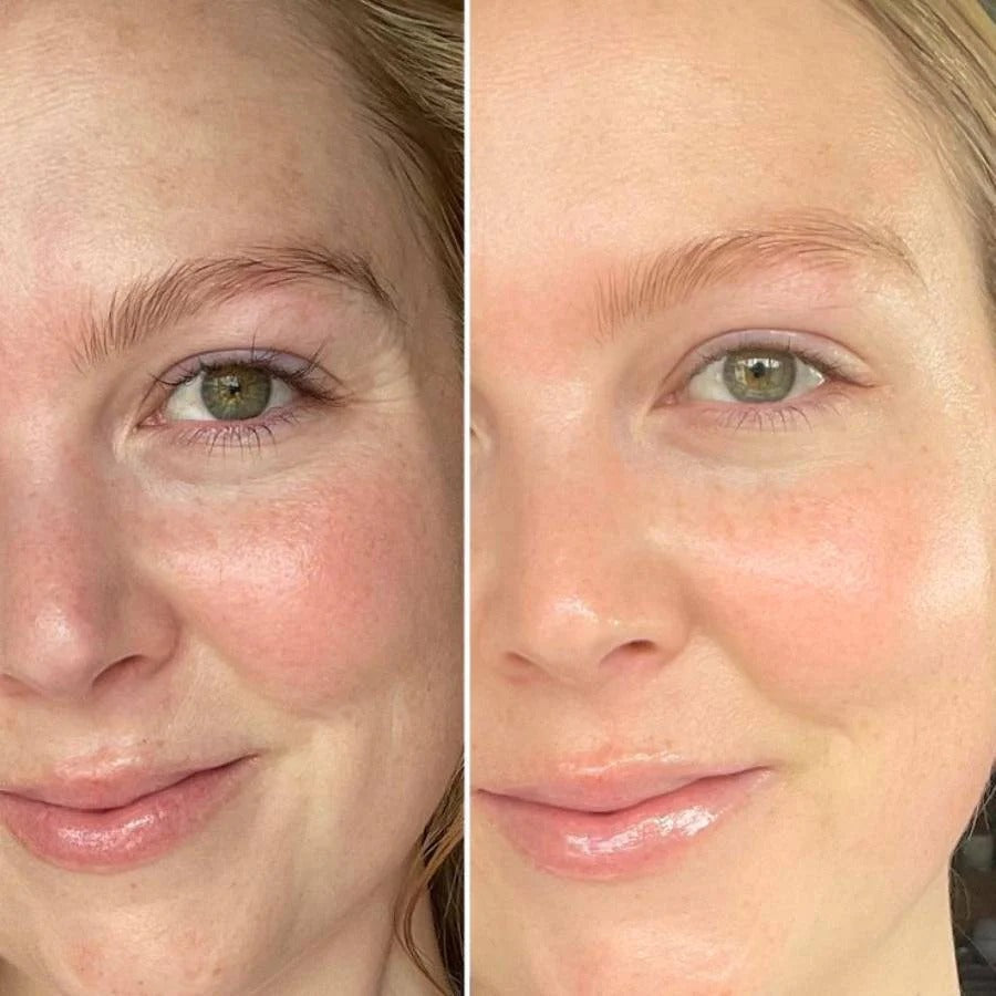 SeoulGlow™- 4% Retinal Liposome Facial Treatment