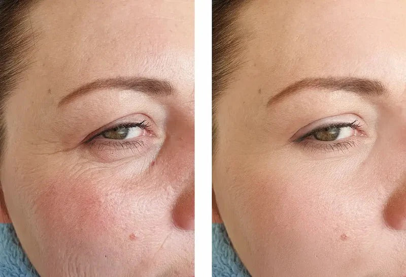 SeoulGlow™- 4% Retinal Liposome Facial Treatment